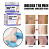 Varicose Vein Treatments Cream Effective Relieve Legs Dilated Vasculitis Phlebitis Natural Formula Ointment for Varicose Veins